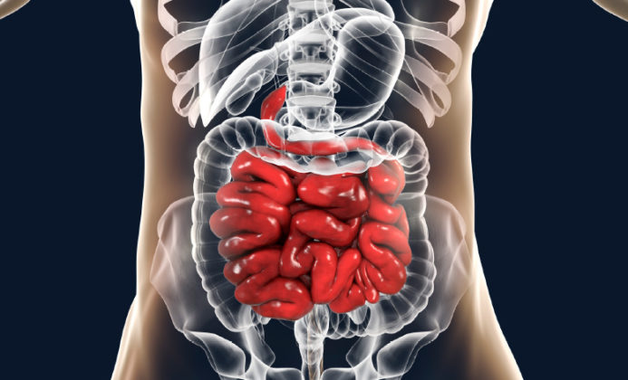 What Is Ileus Disease? Its Causes And Treatment