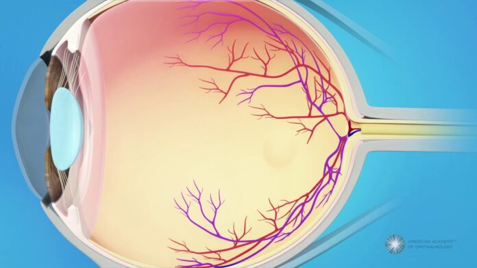 Houston macular pucker treatment